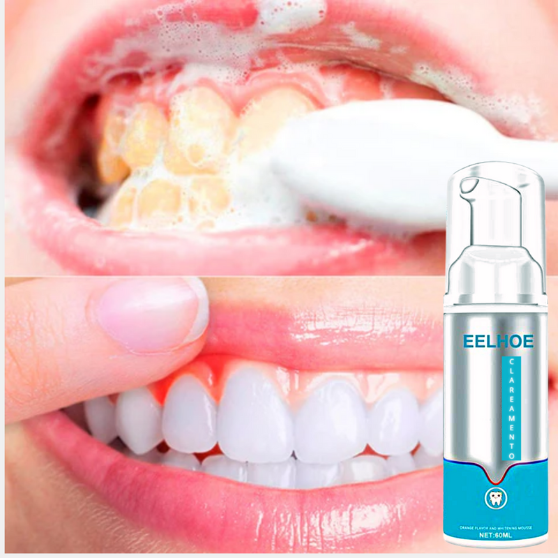 Eelhoe® Clareamento Dental Instantâneo